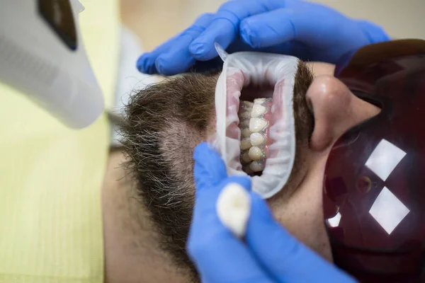 Jeune homme souriant après visite dentiste sur fond flou lumineux. Joli jeune homme souriant regardant caméra. Dentiste examinant les dents des patients en clinique . — Photo