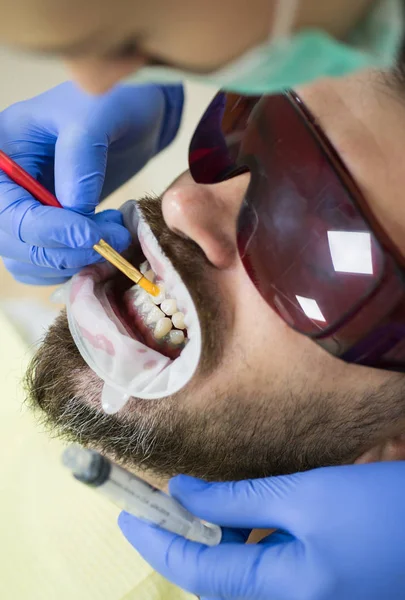 Gros plan d'hommes patients avec barbe à bouche ouverte assis dans une chaise médicale et médecin avec assistant faisant des examens dentaires dans une clinique dentaire. Mignon jeune homme souriant regardant caméra . — Photo