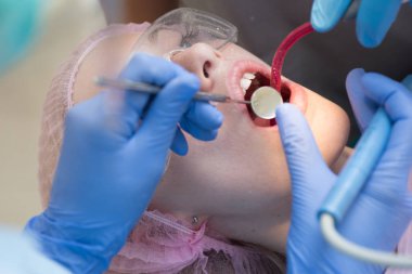 Güzel genç kadın beyaz arka plan sağlıklı dişlere sahip. Bir kadın hasta ziyaret dişçi klinikte diş beyazlatma için yakın çekim portre. Diş Bakımı kavramı.