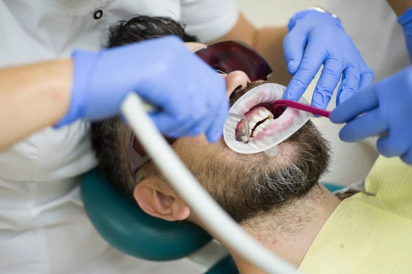 Bel homme européen sourire avec des dents saines blanchissant. Gros plan des hommes patient avec barbe à bouche ouverte assis dans une chaise médicale et médecin avec assistant faire des dents check up dans une clinique dentaire . — Photo