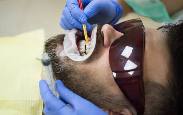 Jeune homme souriant après visite dentiste sur fond flou lumineux. Dentiste examinant les dents des patients à la clinique. Bel homme européen sourire avec des dents saines blanchiment . — Photo
