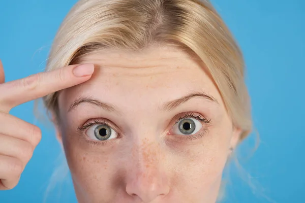 Las primeras arrugas. Mujer preguntándose por las arrugas en la frente. Concepto de cuidado de la piel. Crema de piel anti edad. Cosméticos y cirugía estética. Chica con arrugas en la frente de cerca. Signos de envejecimiento de la piel —  Fotos de Stock