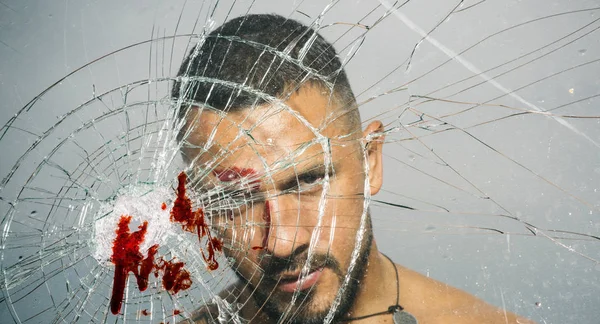 An ill wound is cured. Hispanic man bleeding from bullet wound. Latino man with blood wound on face and broken glass. Handsome wounded guy with skin deep injury wound