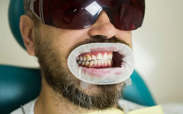 Dentista femenina revisando dientes de paciente con espejo en clínica dental moderna. Dentista comparando blanqueamiento dental de su paciente en clínica dental. Lindo hombre joven sonriendo mirando cámara . — Foto de Stock