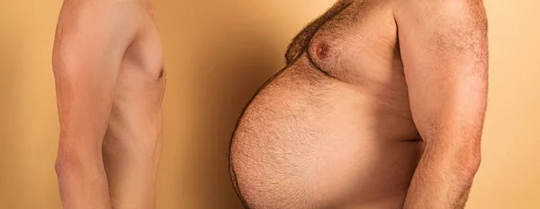 Cuerpo del hombre con diferentes grados de obesidad. Divertida imagen de dos oponentes antagonistas tontos. — Foto de Stock