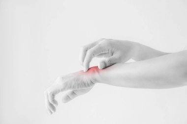 Bileğini tırmalamak kadın.