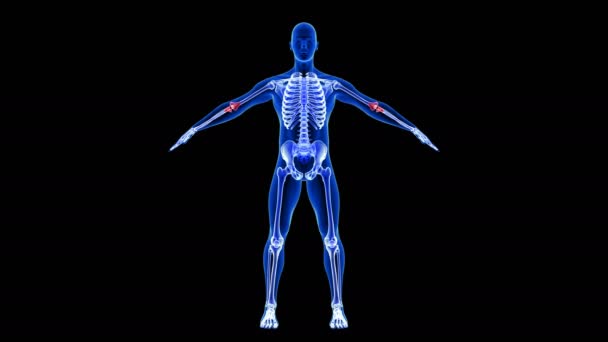 Ο πόνος του αγκώνα. Blue Human Anatomy Body 3D Scan καθιστούν - αδιάλειπτη βρόχο σε μαύρο φόντο — Αρχείο Βίντεο