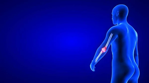 Elbow Pain illustration from rear view - close-up. Blue Human Anatomy Body 3D Scan render - blue background