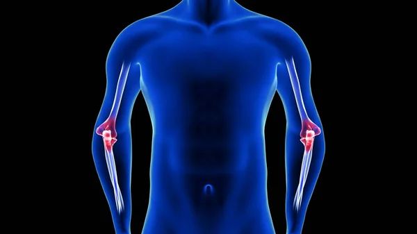 Elbow Pain illustration front view close-up. Blue Human Anatomy Body 3D Scan render on black background — Stock Photo, Image