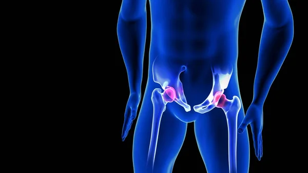 Hip Pain γκρο πλαν εικόνα. Μπλε ανθρώπινη ανατομία σώματος 3D Scan καθιστούν σε μαύρο φόντο — Φωτογραφία Αρχείου