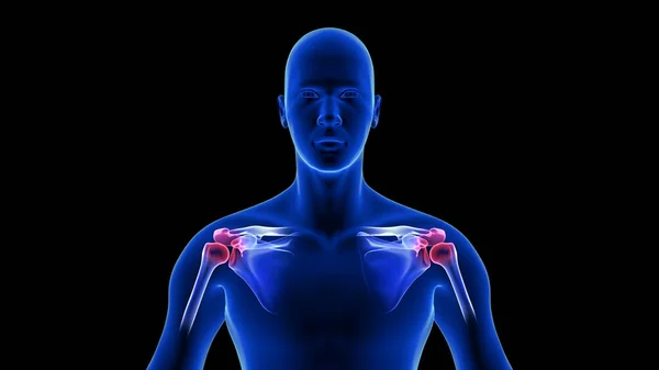 Schulterschmerzen Nahaufnahme Illustration - Vorderansicht. Blue Human Anatomy Body 3D Scan Renderer auf schwarzem Hintergrund — Stockfoto
