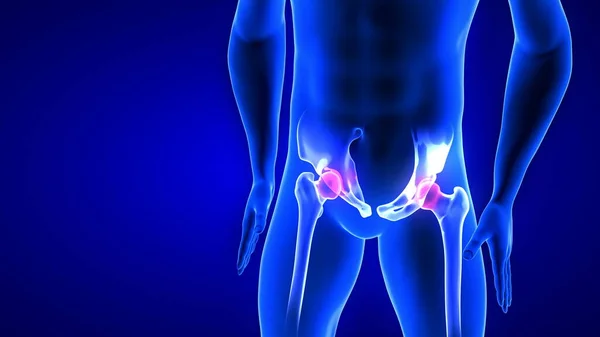 Hip Pain γκρο πλαν εικόνα. Μπλε ανθρώπινη ανατομία σώματος 3D Scan καθιστούν σε μπλε φόντο Royalty Free Εικόνες Αρχείου