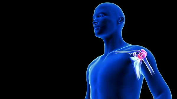 Hombros Dolor ilustración de cerca. Blue Human Anatomy Body 3D Scan render sobre fondo negro — Foto de Stock