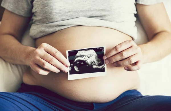 Беременная Женщина Показывает Ультразвуковое Фото — стоковое фото