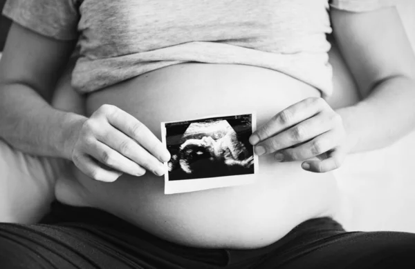 Беременная Женщина Показывает Ультразвуковое Фото — стоковое фото