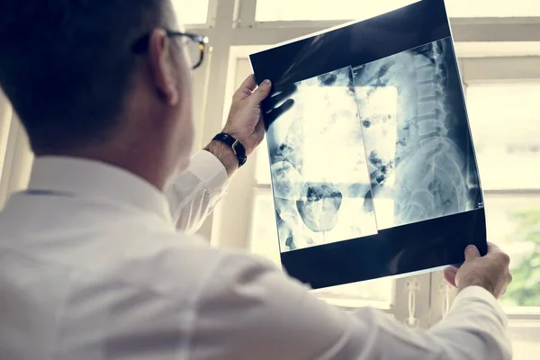 Ο γιατρός ελέγχει ασθενής ακτινογραφία ταινία — Φωτογραφία Αρχείου