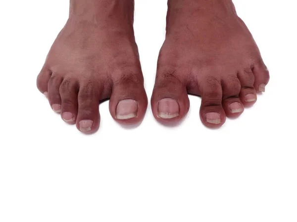 Man Feet selfie Top view on White background Isolated. — Stock Photo, Image
