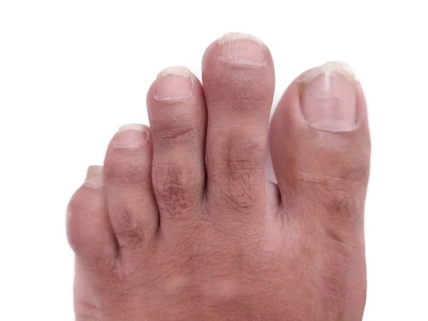 Mans rechter Fuß Finger Nahaufnahme von oben auf weißem Hintergrund — Stockfoto