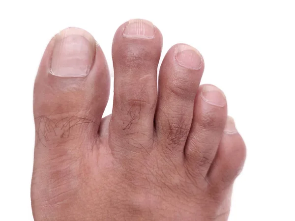 Mans right foot fingers Close-up top view on White background — Stock Photo, Image