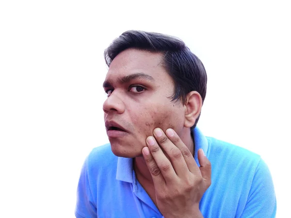 Joven con granos comprobando marcas en la cara — Foto de Stock