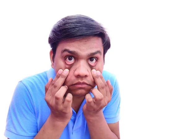 Man open eyes by hand looking into camera — Stock Photo, Image