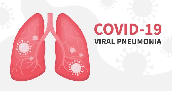Menschliche Lungen und virale Lungenentzündung covid Coronavirus — Stockvektor