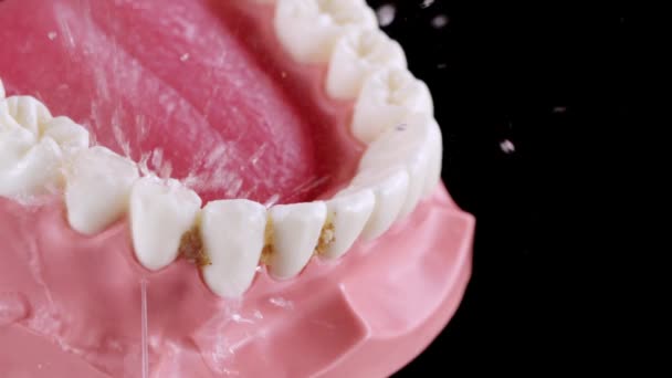 Pulizia dei denti sporchi con filo interdentale — Video Stock