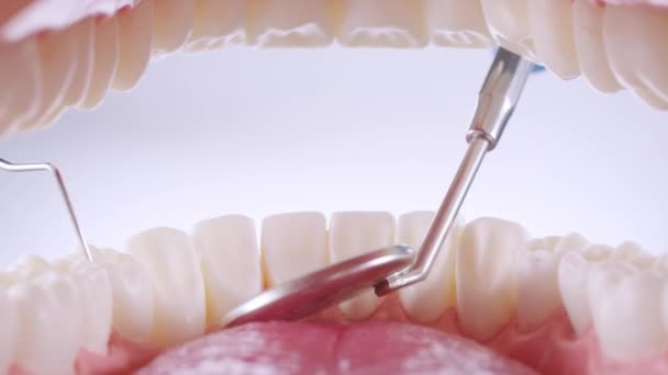 Le dentiste inspecte les dents avec une sonde et un miroir — Video