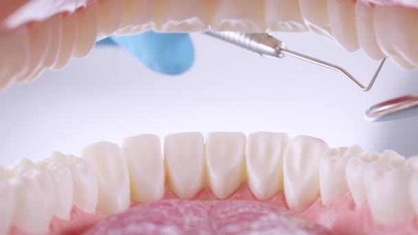 Le dentiste inspecte les dents avec une sonde et un miroir — Video