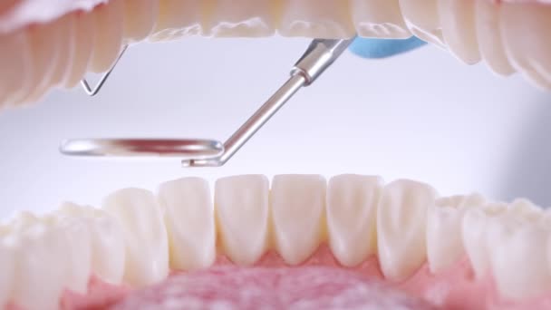 Il dentista ispeziona i denti con sonda e specchio — Video Stock