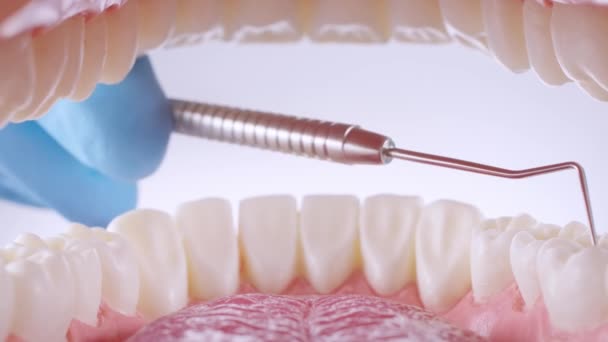 Dentista inspeciona dentes com sonda — Vídeo de Stock