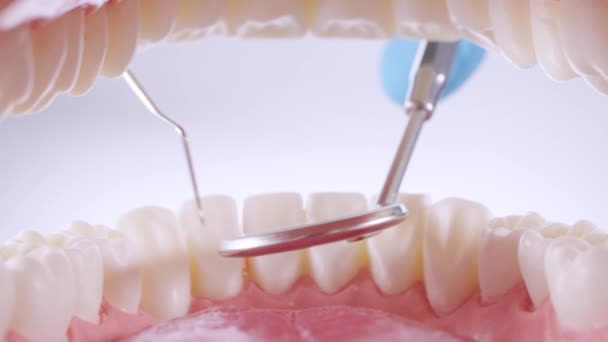 Le dentiste inspecte les dents avec une sonde et un miroir — Video