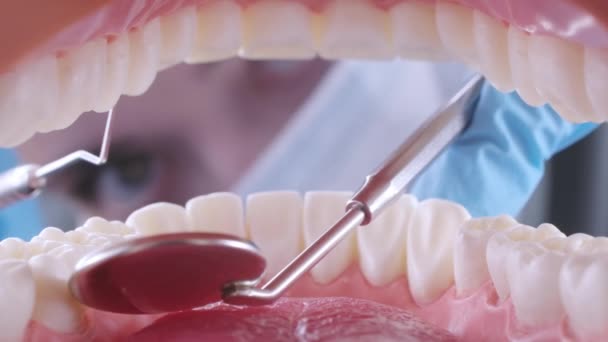 Dentysta bada zęby pacjentów sondą i lustrem — Wideo stockowe