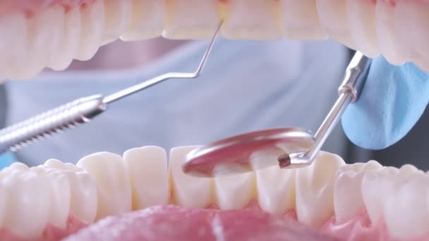 치과의 사는 침과 거울을 사용하여 환자의 치아를 검사 한다 — 비디오