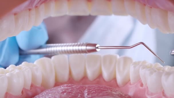 Il dentista ispeziona i denti dei pazienti con sonda e specchio — Video Stock