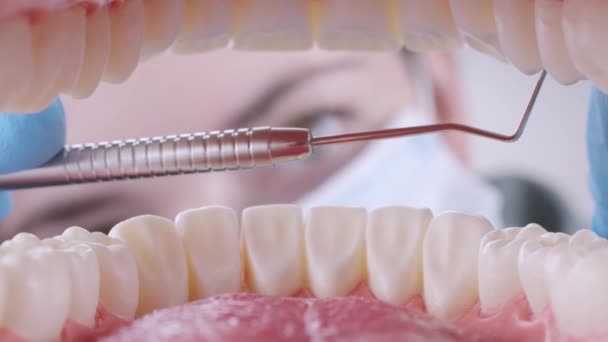 Стоматолог робить зубне наповнення зондом — стокове відео