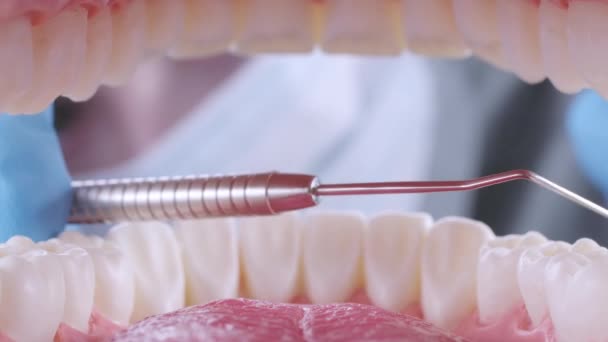 Diş hekimi hastaların dişlerini sonda ve aynayla inceliyor. — Stok video