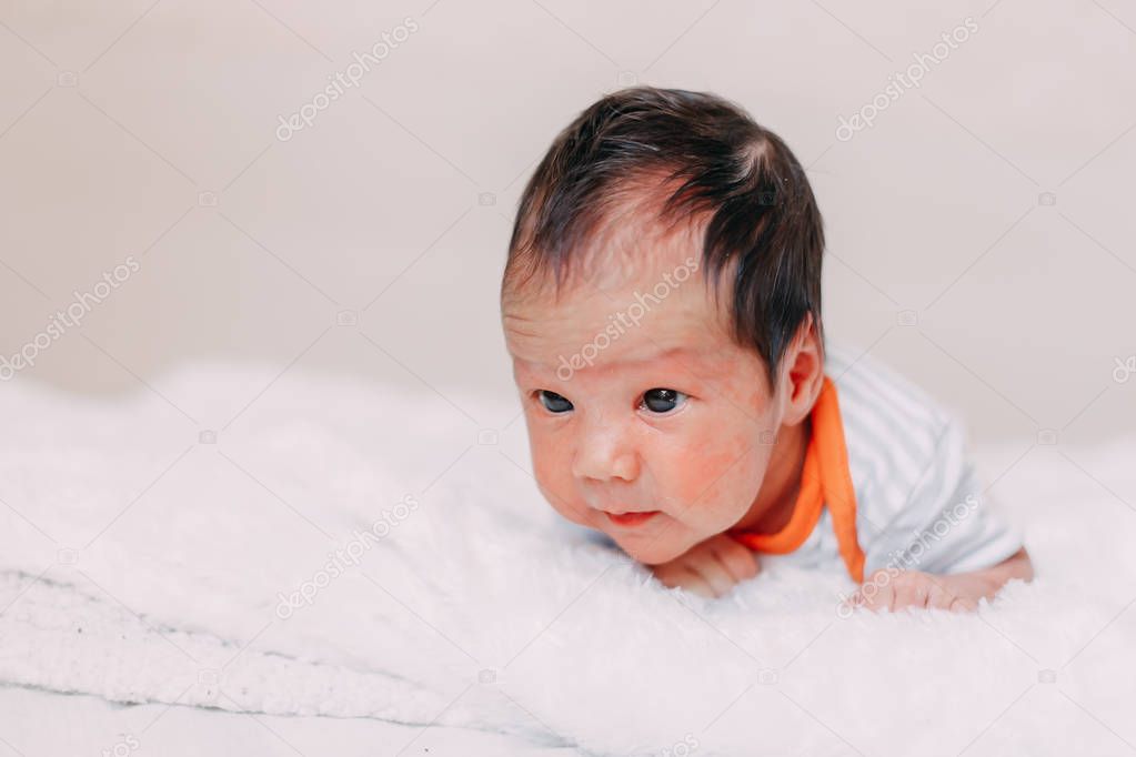 newborn baby boy or girl skin allergy lying on bed