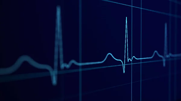 Cardiogram Pols Een Donkere Achtergrond Hartslag Beter Dan Cardiogram Elektrocardiogram — Stockfoto