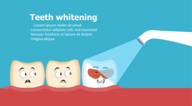 Profesyonel diş beyazlatma vektör çizim