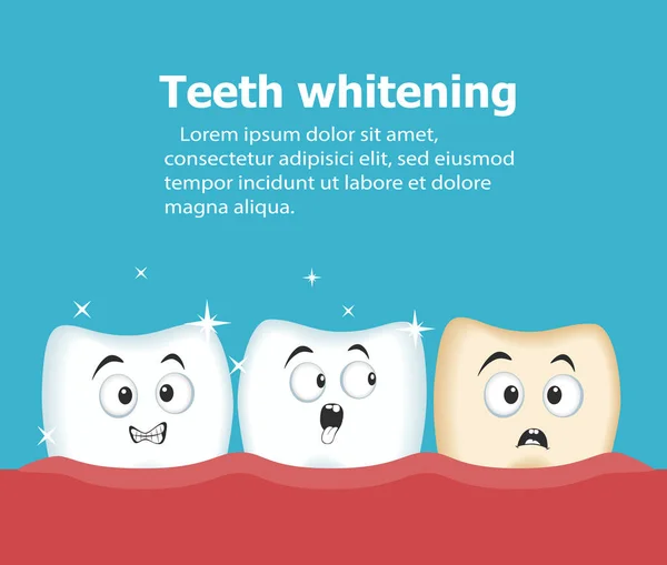 Dientes profesionales blanqueamiento ilustración vectorial — Vector de stock