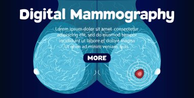 Dijital mamografi afiş