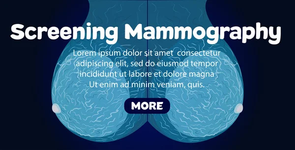 Bannière de mammographie Screeningl — Image vectorielle