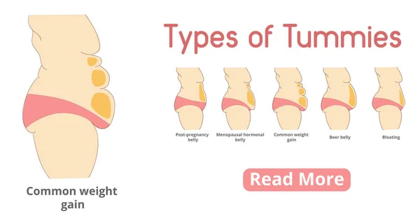 Kadın tummies afiş türleri