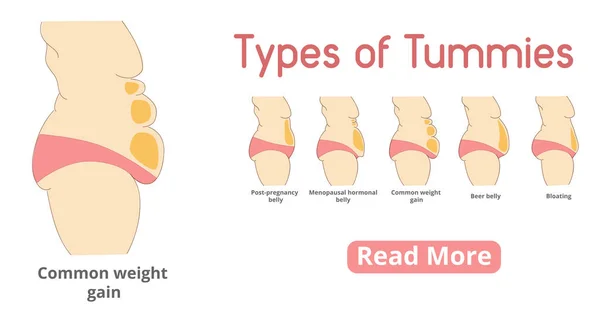 Types de bannière de ventre féminin — Image vectorielle
