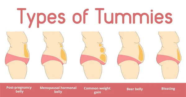 Types de bannière de ventre féminin — Image vectorielle