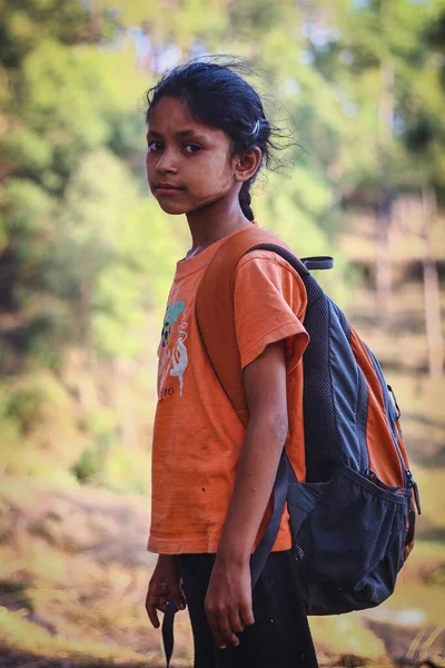 almora, uttrakhand / Hindistan - 14 Haziran 2020: Yüzünde beyaz lekelerle okula giden küçük bir kızın portresi.
