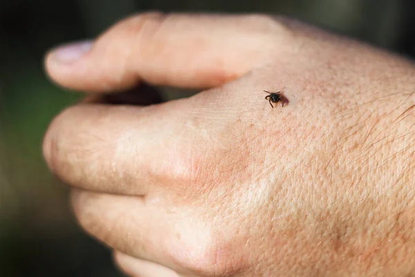 Tvrdé Ixodidae rodiny Ixodidae na kůži lidské ruky — Stock fotografie