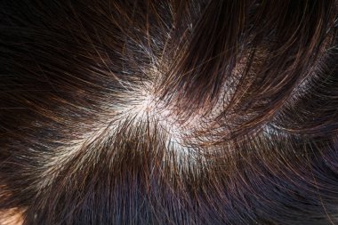 Gri saçlı kadın kafası, yeniden yetişmiş kökleri yakından görme, üst görüş, seçici odaklanma.