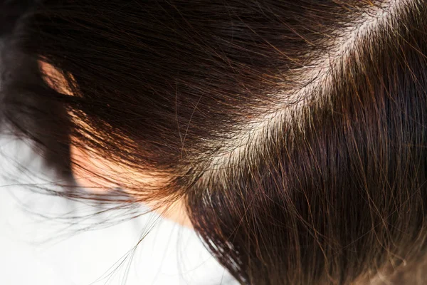 Tête Femme Aux Cheveux Gris Vue Rapprochée Des Racines Repousses — Photo